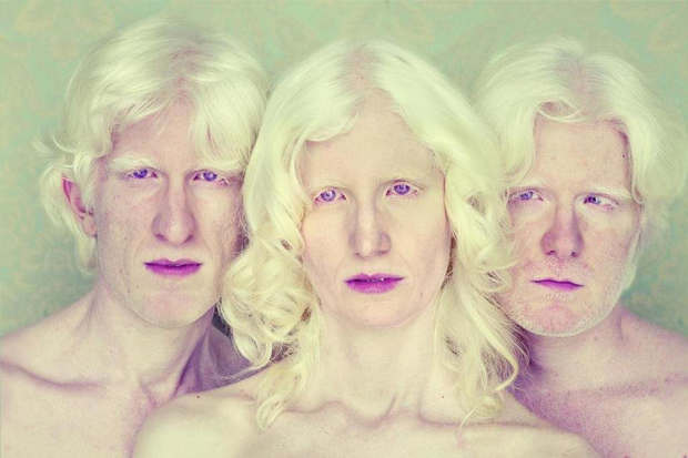 PHotoEspaña 2014 – Albinos, fotografía de Gustavo Lacerda 